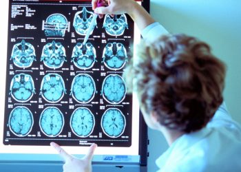 Como saber quando iremos morrer? Um simples exame cerebral pode dar a resposta