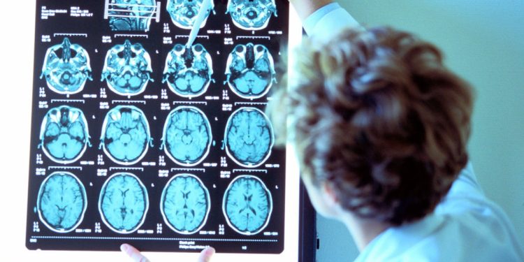 Como saber quando iremos morrer? Um simples exame cerebral pode dar a resposta