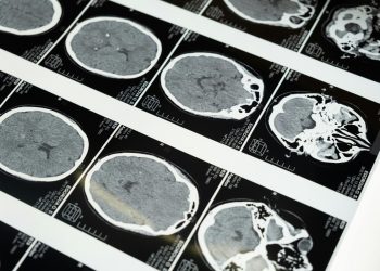Por que o cérebro decide desistir antes do limite real de esforço? Estudo com imagens cerebrais mostra as razões