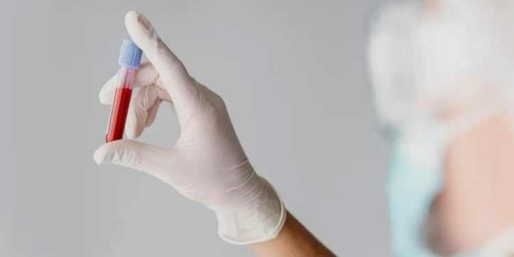 Cientistas descobrem como sangue de jovens pode reverter o envelhecimento de células da pele