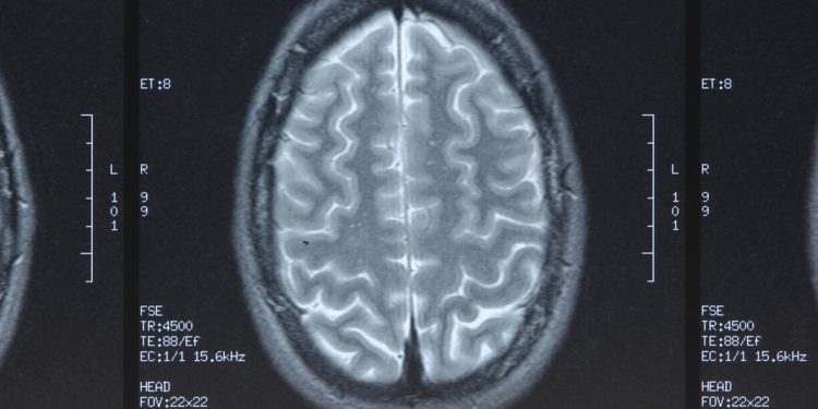 Da esquizofrenia à demência: novos sensores e IA aproximam a 'leitura da mente' da realidade