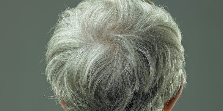 O que cabelos grisalhos podem indicar sobre o risco de câncer de pele, segundo pesquisas