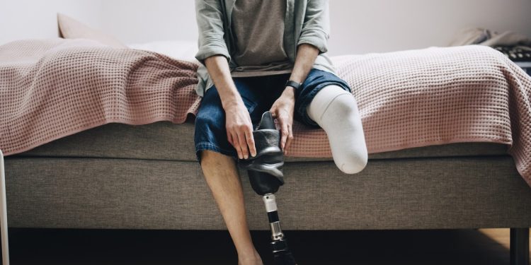 Cientistas descobrem fator-chave para regenerar articulações e membros humanos amputados