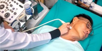 Por que os casos de câncer de tireoide estão aumentando em todo o mundo?